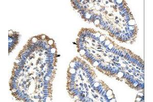 Image no. 1 for anti-Frizzled Family Receptor 9 (FZD9) (AA 181-230) antibody (ABIN202792)