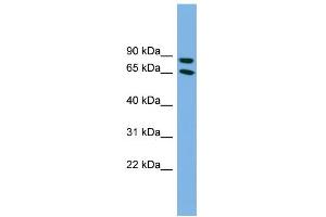 WB Suggested Anti-DAB1 Antibody Titration: 0.