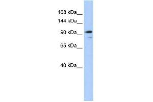 WB Suggested Anti-AMOTL1 Antibody Titration:  0. (AMOTL1 anticorps  (N-Term))
