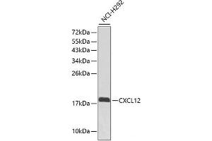 Western blot analysis of extracts of NCI-H292 cells using CXCL12 Polyclonal Antibody. (CXCL12 anticorps)