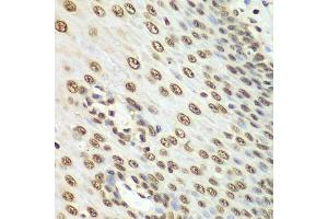 Immunohistochemistry of paraffin-embedded human esophagus using Nono Antibody. (NONO anticorps  (AA 1-300))