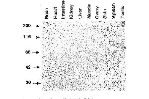 Western Blotting (WB) image for anti-SLA (Haploid Sperm Cell-Specific Antigen) antibody (ABIN3201019) (SLA (Haploid Sperm Cell-Specific Antigen) anticorps)