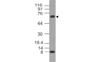 Image no. 1 for anti-Tumor Protein P73 (TP73) antibody (ABIN5027775) (Tumor Protein p73 anticorps)