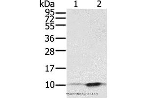 Western blot analysis of A431 and hela cell, using S100P Polyclonal Antibody at dilution of 1:650 (S100P anticorps)