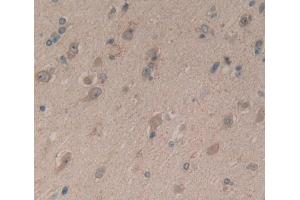 IHC-P analysis of brain tissue, with DAB staining. (Complexin 1 anticorps  (AA 1-134))