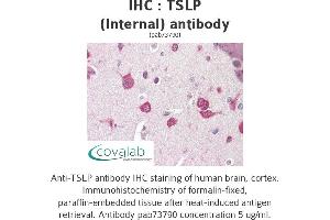 Image no. 1 for anti-Thymic Stromal Lymphopoietin (TSLP) (Internal Region) antibody (ABIN1740422) (Thymic Stromal Lymphopoietin anticorps  (Internal Region))