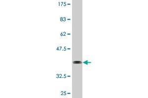 Western Blot detection against Immunogen (36. (HSFY1 anticorps  (AA 1-99))