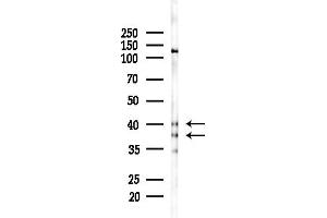 Western blot analysis of lysates from Rat testis, using SUG Antibody at 1/1000 dilution.