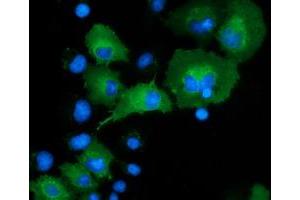 Image no. 2 for anti-DnaJ (Hsp40) Homolog, Subfamily A, Member 2 (DNAJA2) antibody (ABIN1497859) (DNAJA2 anticorps)