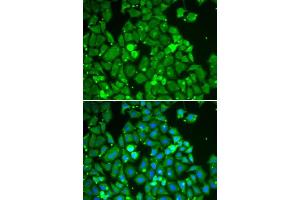 Immunofluorescence (IF) image for anti-Signal Transducer and Activator of Transcription 1, 91kDa (STAT1) (AA 513-712) antibody (ABIN3020615)
