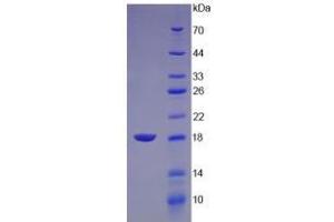 SDS-PAGE analysis of Chicken Lysozyme Protein. (LYZ Protéine)