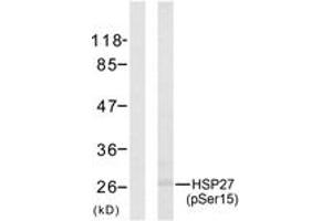 Western blot analysis of extracts from HeLa cells treated with UV, using HSP27 (Phospho-Ser15) Antibody. (HSP27 anticorps  (pSer15))