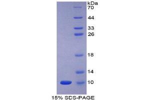 SDS-PAGE (SDS) image for Apelin (APLN) (AA 24-77) protein (His tag,GST tag) (ABIN1078855)