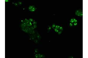 Immunofluorescence staining of PC-3 cells with ABIN7144653 at 1:166, counter-stained with DAPI. (ARNTL anticorps  (AA 366-585))