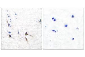Immunohistochemical analysis of paraffin-embedded human brain tissue using Potassium Channel Kv3. (Kv3.2b Potassium Channel anticorps  (C-Term))