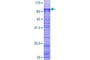Image no. 1 for Zinc Finger Protein 449 (ZNF449) (AA 1-518) protein (GST tag) (ABIN1326208)