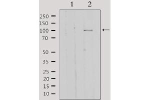 Western blot analysis of extracts from HepG2, using GTF3C2 Antibody.