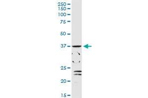 ADH1C MaxPab rabbit polyclonal antibody. (ADH1C anticorps  (AA 1-375))