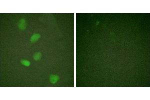 TNF-a - +Immunofluorescence analysis of HeLa cells, treated with TNF-a (20nM, 15mins), using HDAC3 (Ab-424) antibody. (HDAC3 anticorps)