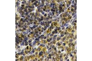 Immunohistochemical analysis of IL-21 staining in human spleen  formalin fixed paraffin embedded tissue section.