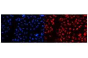 IF analysis of splicing factor 1 using anti-splicing factor 1 antibody (ABIN5692946).