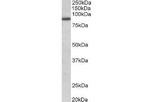 ABIN2562591 (1µg/ml) staining of A549 lysate (35µg protein in RIPA buffer). (FGFR1 anticorps  (Internal Region))