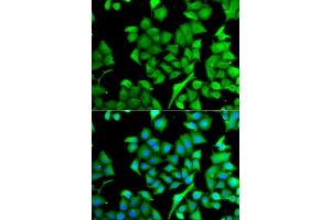Immunofluorescence analysis of A549 cells using NAA50 antibody. (NAA50 anticorps  (AA 1-169))