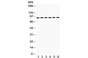 Western blot testing of rat 1) brain, 2) heart, 3) liver, and human 4) HeLa, 5) Jurkat and 6) 22RV1 lysate with HSP90 alpha antibody. (HSP90AA1 anticorps)