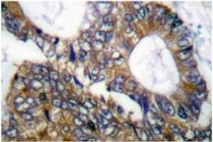 Image no. 1 for anti-Heat Shock 105kDa/110kDa Protein 1 (HSPH1) antibody (ABIN265469) (HSPH1 anticorps)