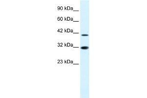 WB Suggested Anti-IRF2 Antibody Titration:  0. (IRF2 anticorps  (N-Term))