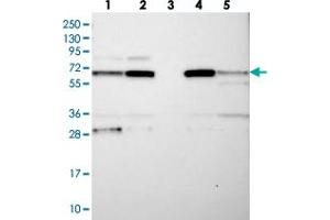 Western blot analysis of Lane 1: RT-4, Lane 2: U-251 MG, Lane 3: Human Plasma, Lane 4: Liver, Lane 5: Tonsil with CPEB4 polyclonal antibody  at 1:250-1:500 dilution.
