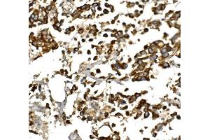 IHC analysis of IGF1 using anti-IGF1 antibody (ABIN7601895).