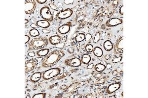 IHC analysis of SH2D4A using anti-SH2D4A antibody (ABIN7601695). (SH2D4A anticorps  (AA 42-454))