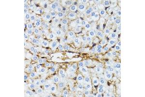 Immunohistochemistry of paraffin-embedded mouse liver using SERPING1 antibody (ABIN6290125) at dilution of 1:100 (40x lens). (SERPING1 anticorps)