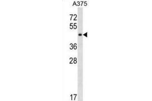 Western Blotting (WB) image for anti-SGT1, Suppressor of G2 Allele of SKP1 (SUGT1) antibody (ABIN3000456) (SUGT1 anticorps)
