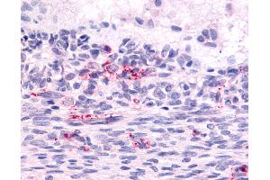 Anti-LPHN2 antibody IHC of human ovary, Graafian follicle. (LPHN2 anticorps  (N-Term))