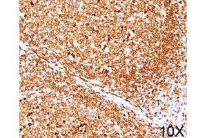 IHC testing of human tonsil (10X) stained with CD79a antibody (JCB117). (CD79a anticorps  (AA 202-216))