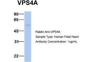 Host: Rabbit Target Name: VPS4A Sample Type: Human Fetal Heart Antibody Dilution: 1. (VPS4A anticorps  (N-Term))