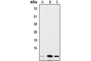 Western blot analysis of Insulin expression in A549 (A), mouse heart (B), rat liver (C) whole cell lysates. (Insulin anticorps  (Center))