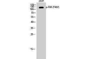 Western Blotting (WB) image for anti-PTK2 Protein tyrosine Kinase 2 (PTK2) (pTyr407) antibody (ABIN3179647) (FAK anticorps  (pTyr407))