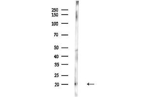 anti-CGRP Receptor Component (CRCP) (N-Term) antibody