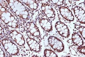 Immunohistochemistry of paraffin-embedded human colon using MSH2 Rabbit mAb (ABIN7268547) at dilution of 1:100 (40x lens). (MSH2 anticorps)