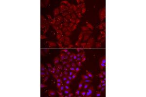 Immunofluorescence analysis of U2OS cells using TPP2 antibody. (Tpp2 anticorps  (AA 1-300))