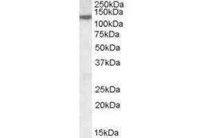 Image no. 1 for anti-Solute Carrier Family 12 (Potassium-Chloride Transporter) Member 6 (SLC12A6) (Internal Region) antibody (ABIN374883) (SLC12A6 anticorps  (Internal Region))