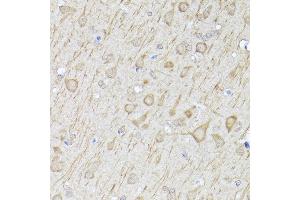 Immunohistochemistry of paraffin-embedded rat brain using [KO Validated] LC3B Rabbit pAb (ABIN6134220, ABIN6143470, ABIN6143475 and ABIN6215146) at dilution of 1:100 (40x lens). (LC3B anticorps  (AA 1-100))