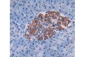 Used in DAB staining on fromalin fixed paraffin- embedded Kidney tissue (ACVR1C/ALK7 anticorps  (AA 21-493))