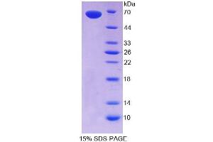 SDS-PAGE analysis of Human CLEC11A Protein. (CLEC11A Protéine)