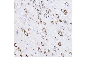 Immunohistochemistry of paraffin-embedded rat brain using RPL8 Rabbit pAb (ABIN6128659, ABIN6147155, ABIN6147156 and ABIN6214154) at dilution of 1:50 (40x lens). (RPL8 anticorps  (AA 1-257))