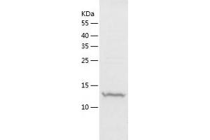 Western Blotting (WB) image for Nucleoside diphosphate kinase B (NME2) (AA 1-152) protein (His-IF2DI Tag) (ABIN7124228)