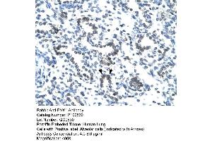 Human Lung (EVX1 anticorps  (N-Term))